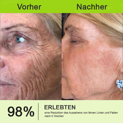 ✨✅Jetzt jugendliche Haut zurückgewinnen 💫Rolimey® Botox & Vita-A Retinol Shot Falten-Lift Straffungscreme