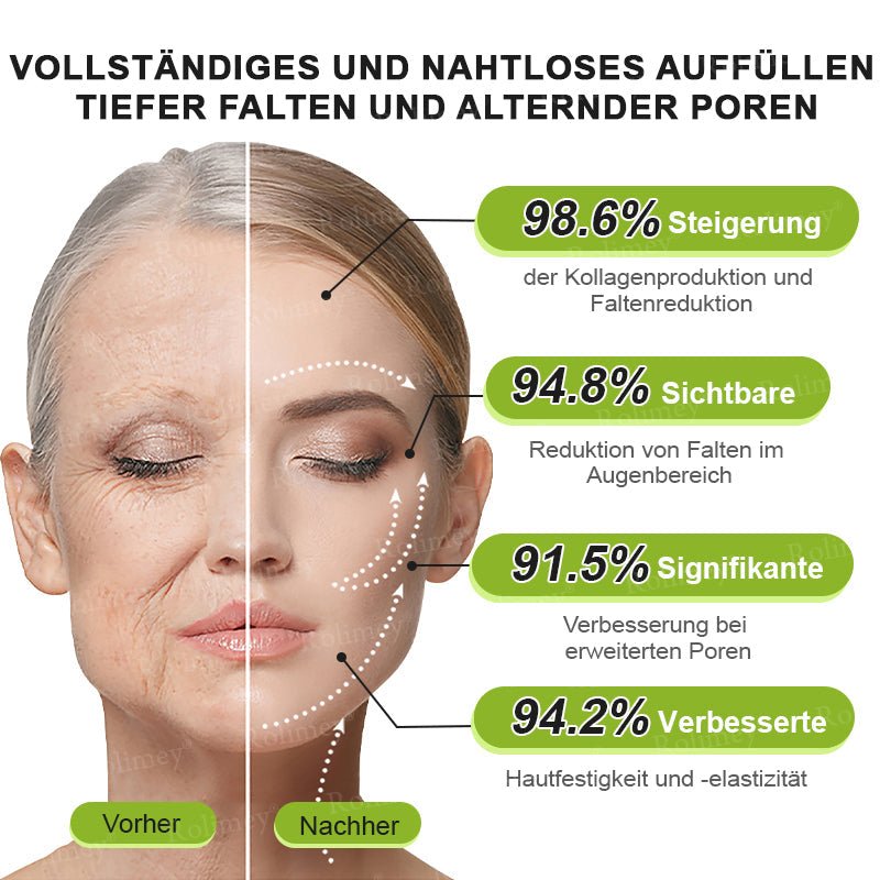 ✨✅Jetzt jugendliche Haut zurückgewinnen 💫Rolimey® Botox & Vita-A Retinol Shot Falten-Lift Straffungscreme