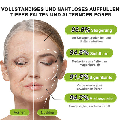 ✨✅Jetzt jugendliche Haut zurückgewinnen 💫Rolimey® Botox & Vita-A Retinol Shot Falten-Lift Straffungscreme
