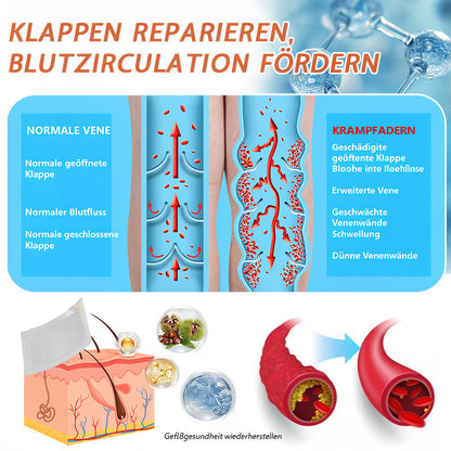 💯✨Celsiora® Vein Ease Mikronadel-Pflegepflaster (Bei Besenreisern, Krampfadern, Schwellungen & müden Beinen) 🔥 Letzter Aktionstag – 50% Rabatt