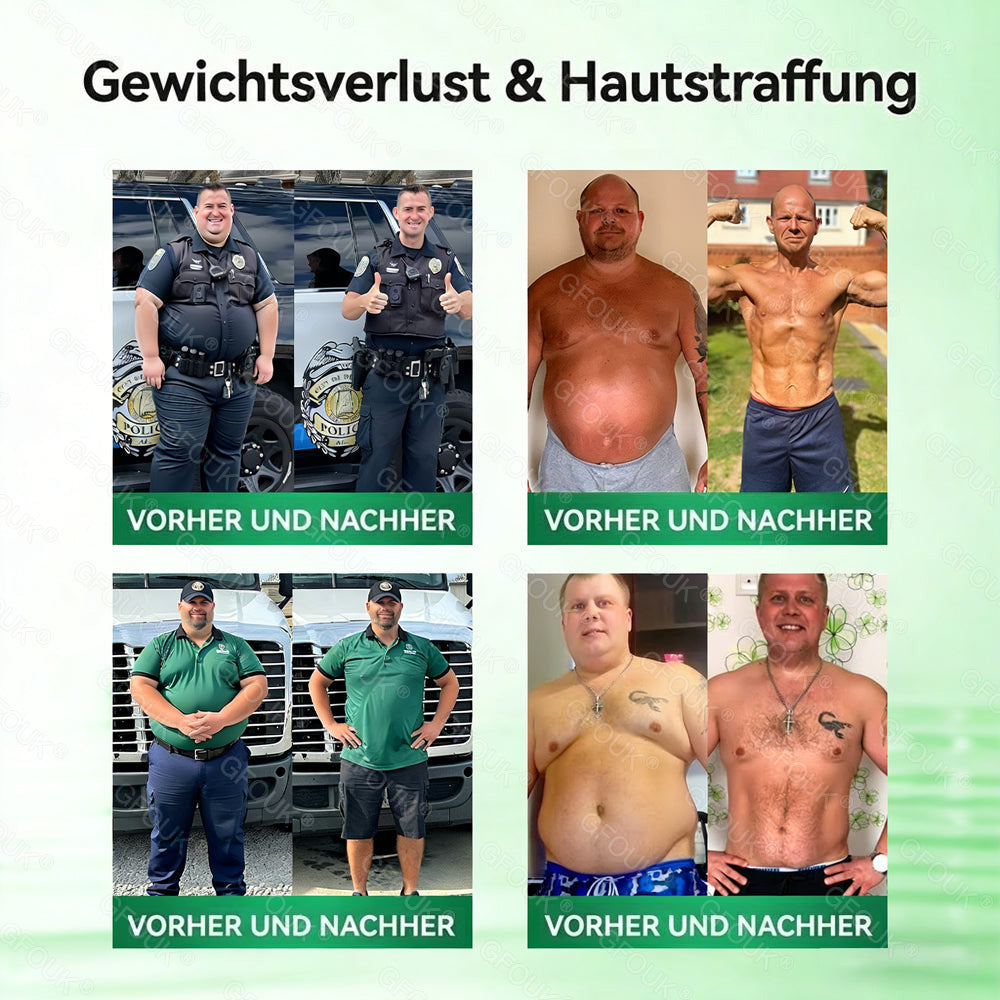 ❤️🇩🇪𝗢𝗳𝗳𝗶𝘇𝗶𝗲𝗹𝗹𝗲𝗿 𝗦𝗵𝗼𝗽 | 🎁 𝗚𝗙𝗢𝗨𝗞® 𝗠𝗼𝗿𝗶𝗻𝗴𝗮 𝗕𝗲𝗿𝗯𝗲𝗿𝗶𝗻𝗲𝘅 𝗡𝗔𝗗+ 𝟭𝟬-𝗶𝗻-𝟭 𝗡𝗮𝗻𝗼-𝗠𝗶𝗸𝗿𝗼𝗻𝗮𝗱𝗲𝗹-𝗣𝗮𝘁𝗰𝗵 (𝗡𝘂𝗿 𝗲𝗶𝗻𝗺𝗮𝗹 𝘁ä𝗴𝗹𝗶𝗰𝗵, 𝘀𝗶𝗰𝗵𝘁𝗯𝗮𝗿𝗲 𝗩𝗲𝗿ä𝗻𝗱𝗲𝗿𝘂𝗻𝗴𝗲𝗻 𝗶𝗻 𝟳 𝗧𝗮𝗴𝗲𝗻) ✅ 𝗙ü𝗿 Ü𝗯𝗲𝗿𝗴𝗲𝘄𝗶𝗰𝗵𝘁, 𝗹𝗼𝗰𝗸𝗲𝗿𝗲 𝗛𝗮𝘂𝘁, 𝗗𝗶𝗮𝗯𝗲𝘁𝗲𝘀, 𝗦𝗰𝗵𝗹𝗮𝗳𝗮𝗽𝗻𝗼𝗲, 𝗚𝗲𝗹𝗲𝗻𝗸𝗽𝗿𝗼𝗯𝗹𝗲𝗺𝗲 𝘂𝗻𝗱 𝗺𝗲𝗵𝗿