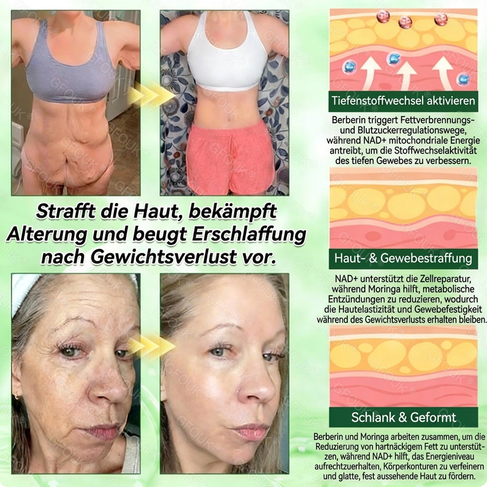 ❤️🇩🇪𝗢𝗳𝗳𝗶𝘇𝗶𝗲𝗹𝗹𝗲𝗿 𝗦𝗵𝗼𝗽 | 🎁 𝗚𝗙𝗢𝗨𝗞® 𝗠𝗼𝗿𝗶𝗻𝗴𝗮 𝗕𝗲𝗿𝗯𝗲𝗿𝗶𝗻𝗲𝘅 𝗡𝗔𝗗+ 𝟭𝟬-𝗶𝗻-𝟭 𝗡𝗮𝗻𝗼-𝗠𝗶𝗸𝗿𝗼𝗻𝗮𝗱𝗲𝗹-𝗣𝗮𝘁𝗰𝗵 (𝗡𝘂𝗿 𝗲𝗶𝗻𝗺𝗮𝗹 𝘁ä𝗴𝗹𝗶𝗰𝗵, 𝘀𝗶𝗰𝗵𝘁𝗯𝗮𝗿𝗲 𝗩𝗲𝗿ä𝗻𝗱𝗲𝗿𝘂𝗻𝗴𝗲𝗻 𝗶𝗻 𝟳 𝗧𝗮𝗴𝗲𝗻) ✅ 𝗙ü𝗿 Ü𝗯𝗲𝗿𝗴𝗲𝘄𝗶𝗰𝗵𝘁, 𝗹𝗼𝗰𝗸𝗲𝗿𝗲 𝗛𝗮𝘂𝘁, 𝗗𝗶𝗮𝗯𝗲𝘁𝗲𝘀, 𝗦𝗰𝗵𝗹𝗮𝗳𝗮𝗽𝗻𝗼𝗲, 𝗚𝗲𝗹𝗲𝗻𝗸𝗽𝗿𝗼𝗯𝗹𝗲𝗺𝗲 𝘂𝗻𝗱 𝗺𝗲𝗵𝗿
