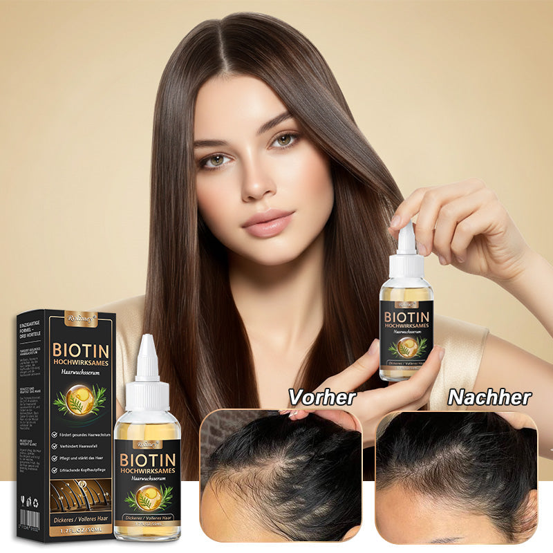 ✅🌿Offizieller Store 🇩🇪 | 🔥Rolimey® Hochwirksames Biotin & Rosmarin Haarwachstumsserum– Füllt lichte Stellen & Geheimratsecken sichtbar auf (🔥Zeitlich begrenzter Rabatt, ⏳letzte 30 Minuten)