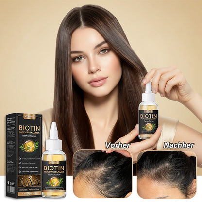 ✅🌿Offizieller Store 🇩🇪 | 🔥Rolimey® Hochwirksames Biotin & Rosmarin Haarwachstumsserum– Füllt lichte Stellen & Geheimratsecken sichtbar auf (🔥Zeitlich begrenzter Rabatt, ⏳letzte 30 Minuten)