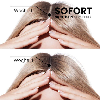 ✅🌟Offizieller Store 🇩🇪 | 🔥Rolimey® Hochwirksames Biotin & Rosmarin Haarwachstumsserum– Füllt lichte Stellen & Geheimratsecken sichtbar auf (🔥Zeitlich begrenzter Rabatt, ⏳letzte 30 Minuten)