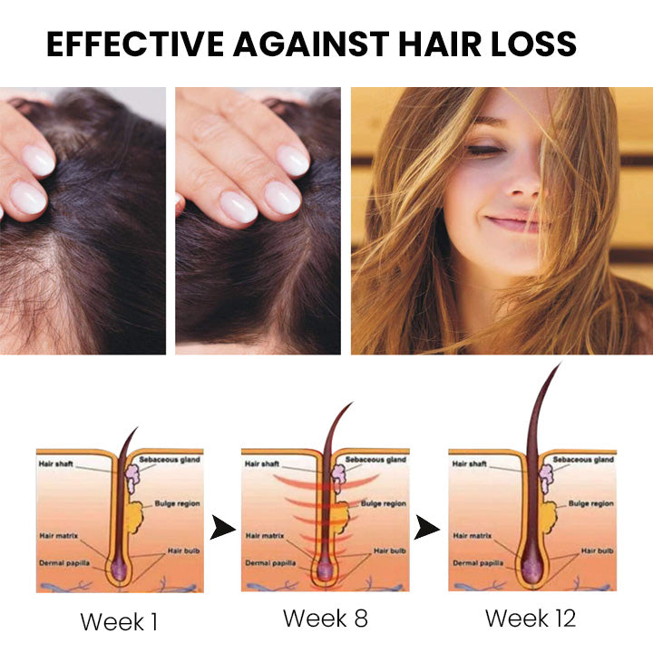✅🌿Offizieller Store 🇩🇪 | 🔥Rolimey® Hochwirksames Biotin & Rosmarin Haarwachstumsserum– Füllt lichte Stellen & Geheimratsecken sichtbar auf (🔥Zeitlich begrenzter Rabatt, ⏳letzte 30 Minuten)