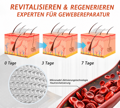 💯✨Celsiora® Vein Ease Mikronadel-Pflegepflaster (Bei Besenreisern, Krampfadern, Schwellungen & müden Beinen) 🔥 Letzter Aktionstag – 50% Rabatt
