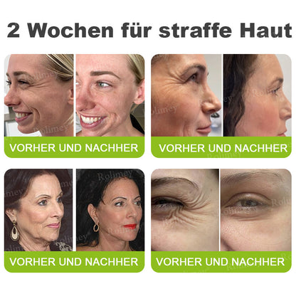 ✨✅Jetzt jugendliche Haut zurückgewinnen 💫Rolimey® Botox & Vita-A Retinol Shot Falten-Lift Straffungscreme