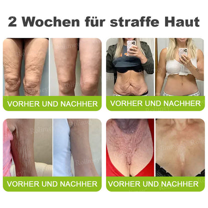 ✨✅Jetzt jugendliche Haut zurückgewinnen 💫Rolimey® Botox & Vita-A Retinol Shot Falten-Lift Straffungscreme