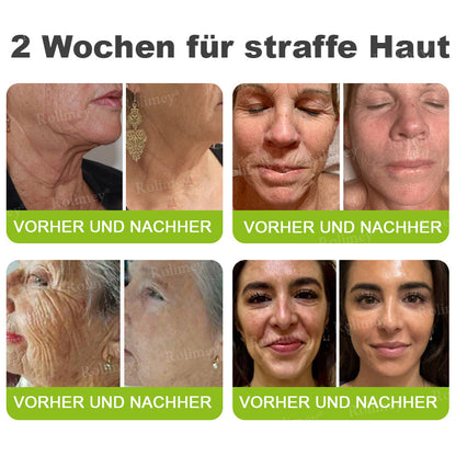 ✨✅Jetzt jugendliche Haut zurückgewinnen 💫Rolimey® Botox & Vita-A Retinol Shot Falten-Lift Straffungscreme