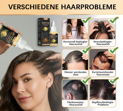 ✅🌟Offizieller Store 🇩🇪 | 🔥Rolimey® Hochwirksames Biotin & Rosmarin Haarwachstumsserum– Füllt lichte Stellen & Geheimratsecken sichtbar auf (🔥Zeitlich begrenzter Rabatt, ⏳letzte 30 Minuten)